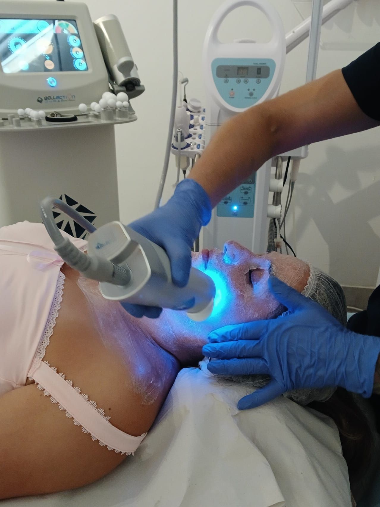 Una persona se somete a un tratamiento facial con luz azul. Dos manos enguantadas sostienen un dispositivo en el rostro. El entorno parece ser un consultorio médico.
