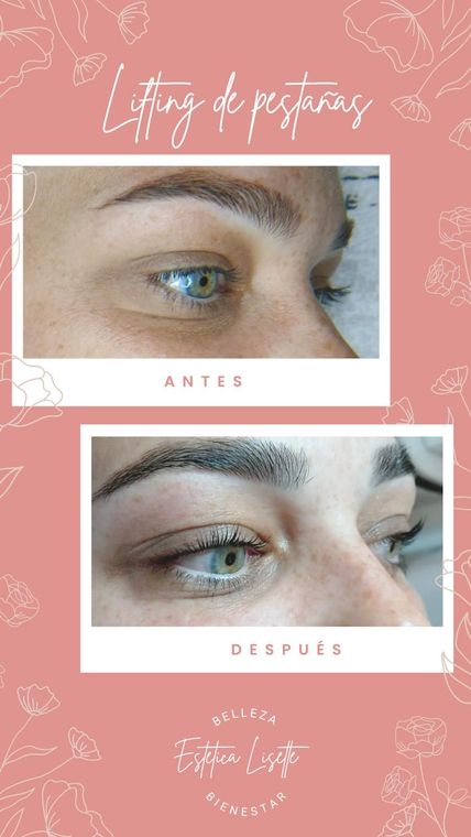Comparación del antes y el después de los ojos de una mujer. El 