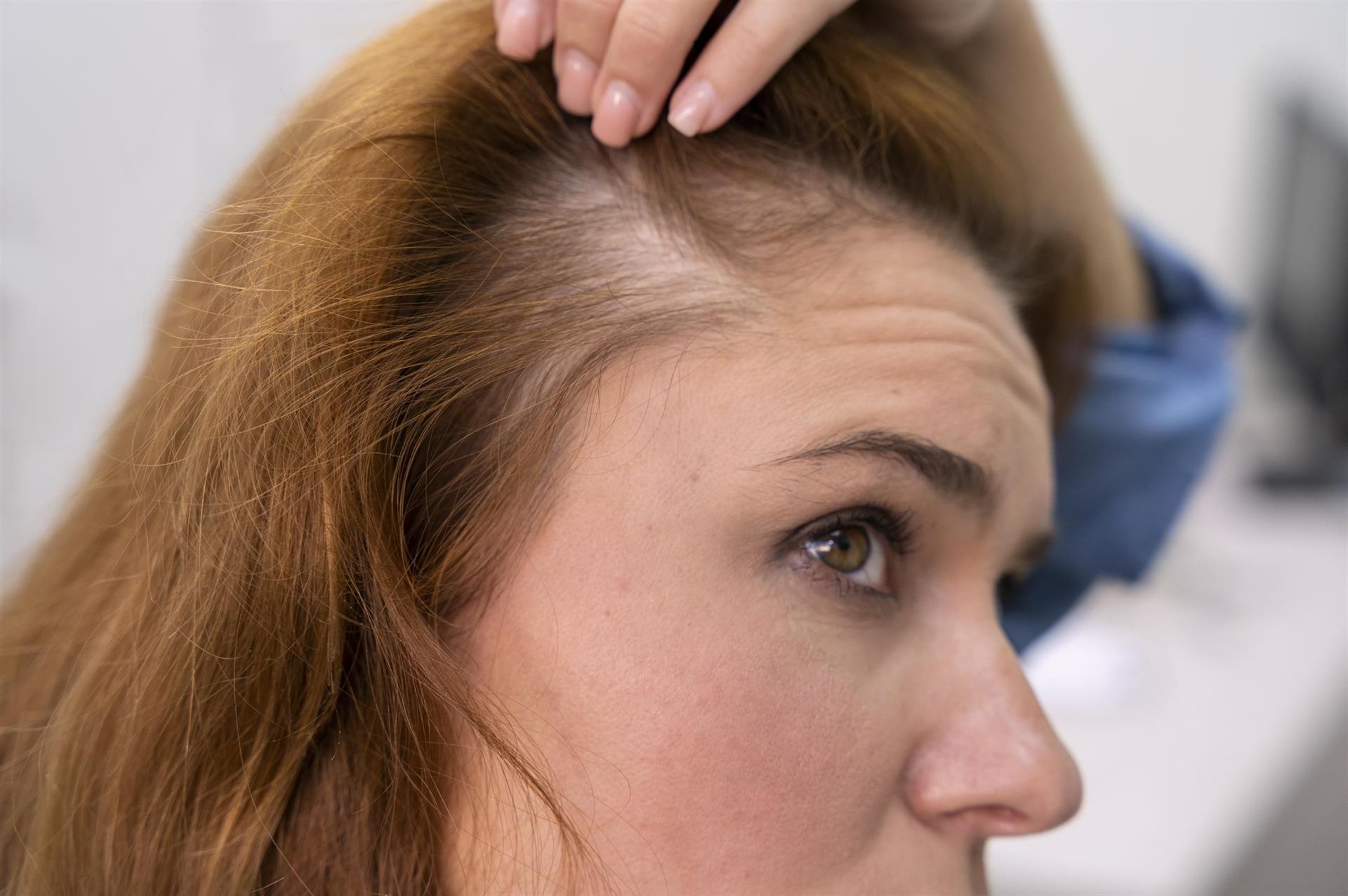 Haarausfall Frau Haarausfall Frau