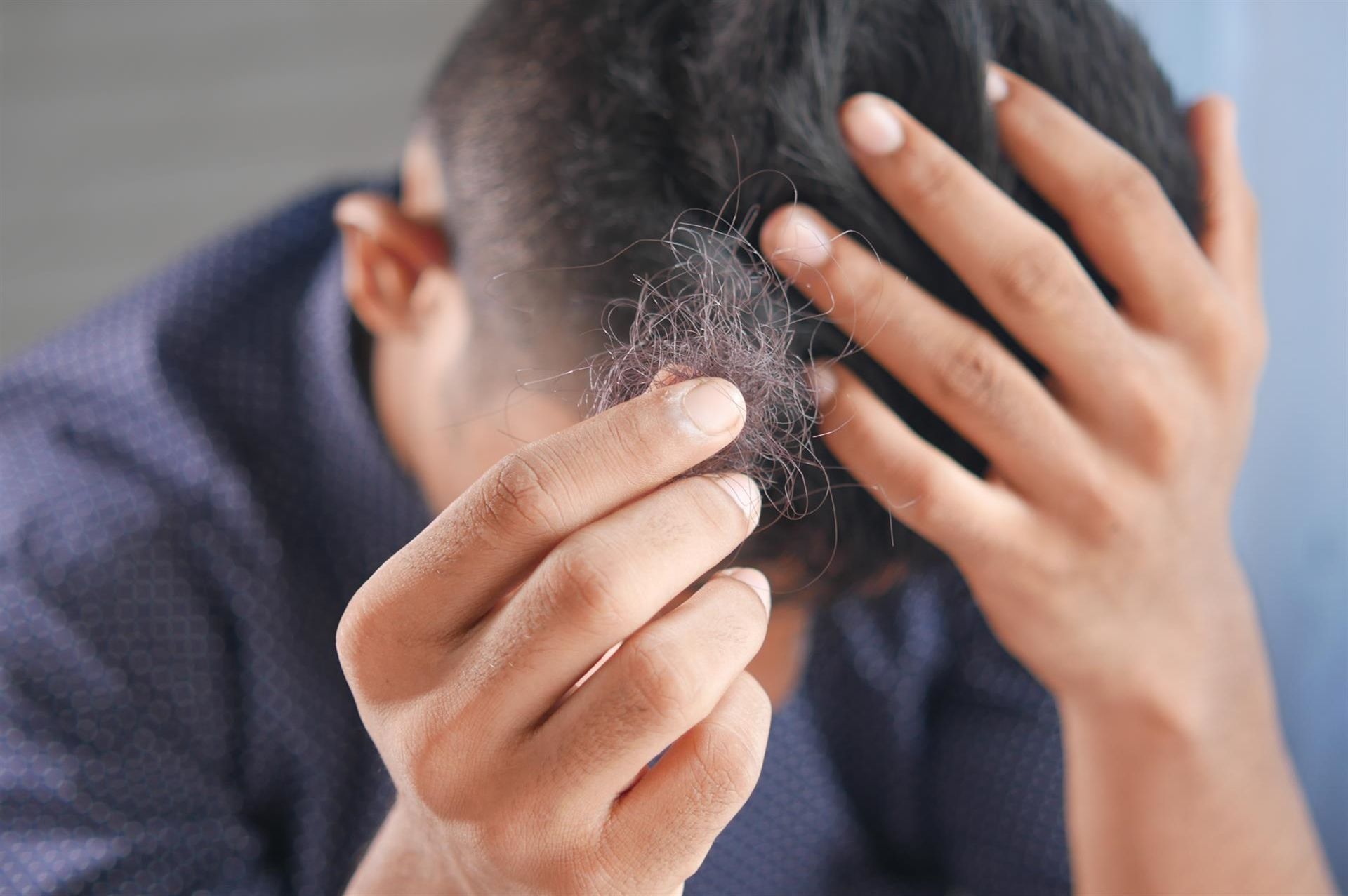 Haarausfall Mann Haarausfall Mann