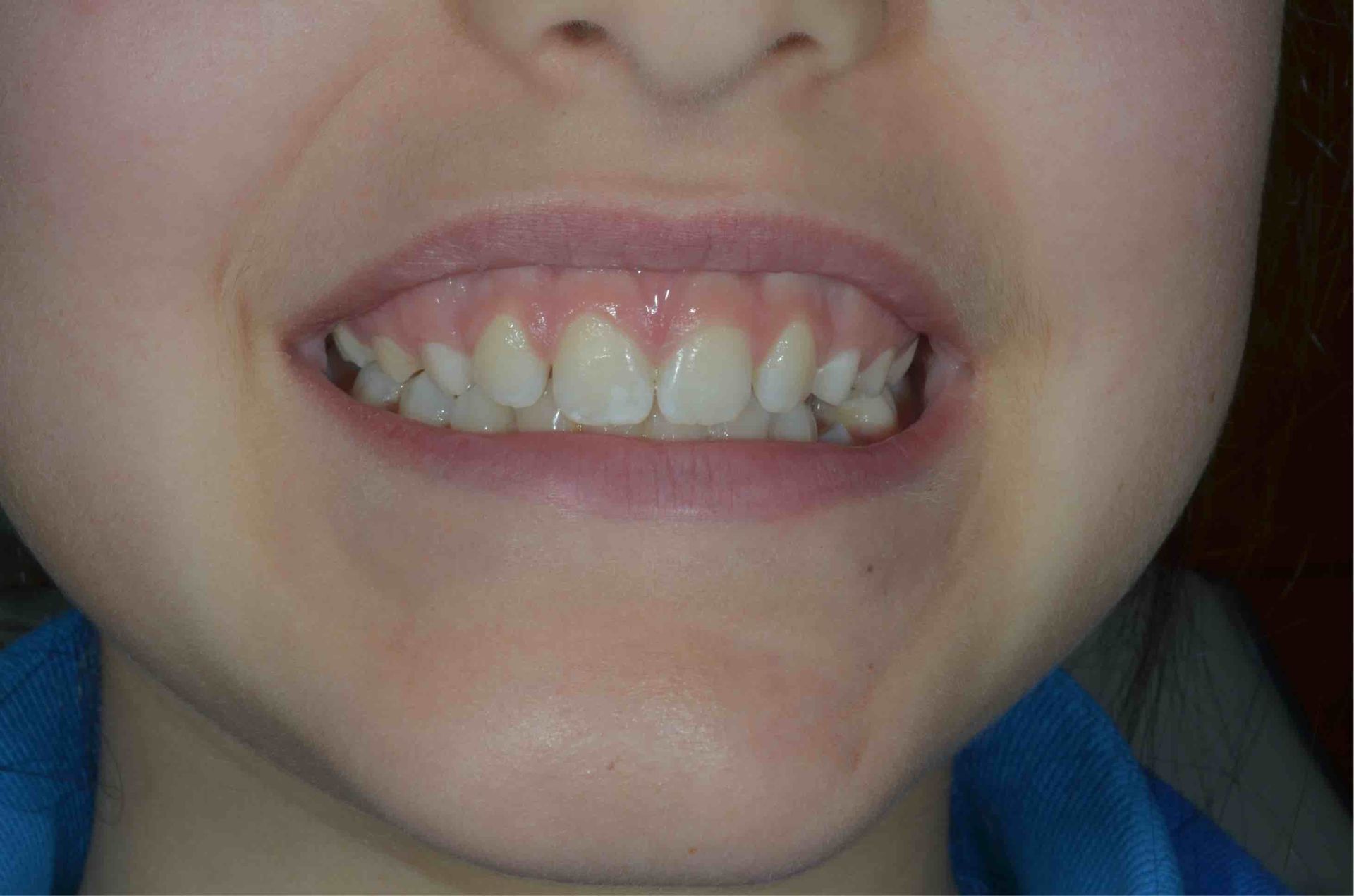 Sorriso di un bambino
