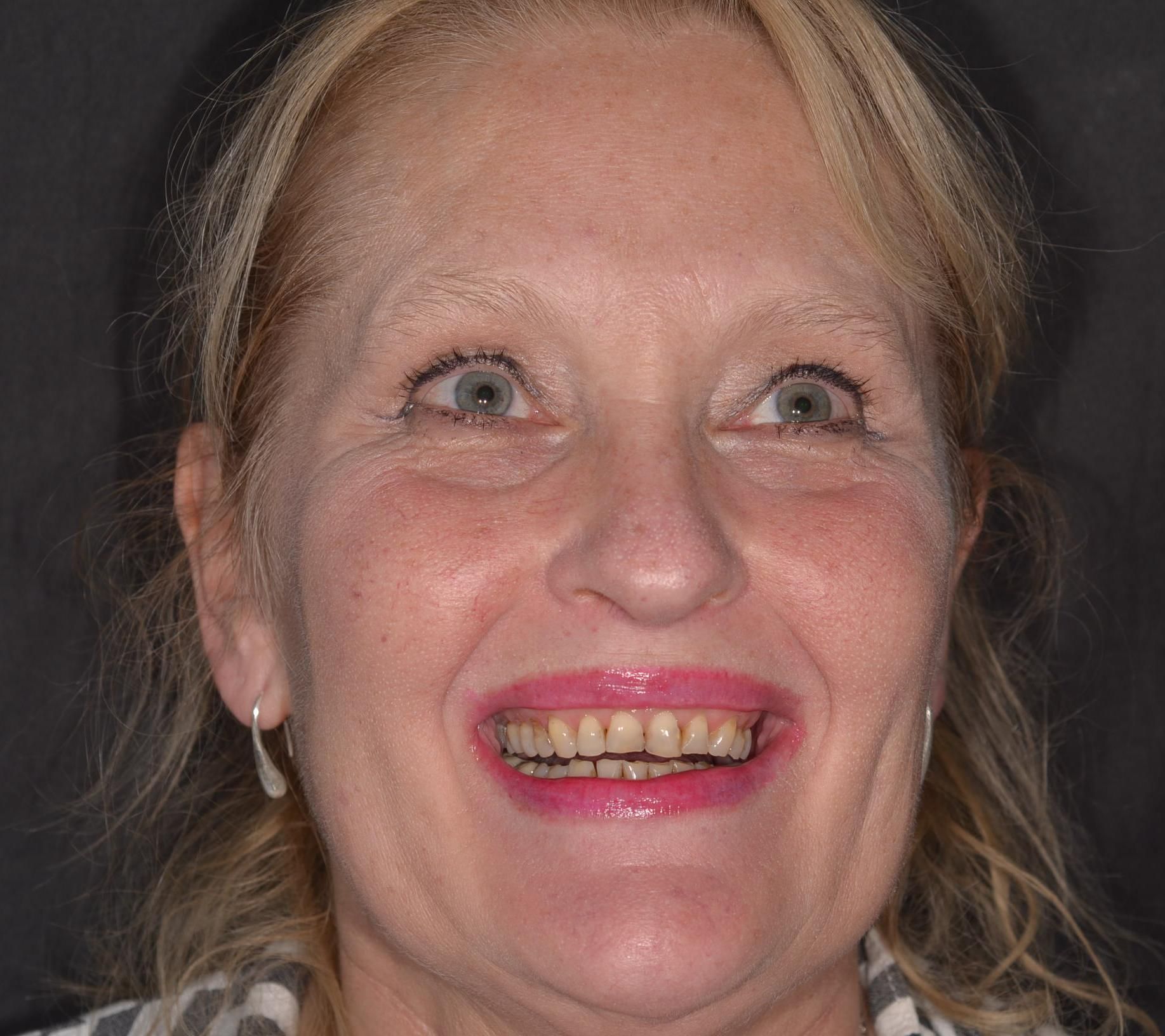 Un primo piano del volto di una donna con un sorriso sul viso