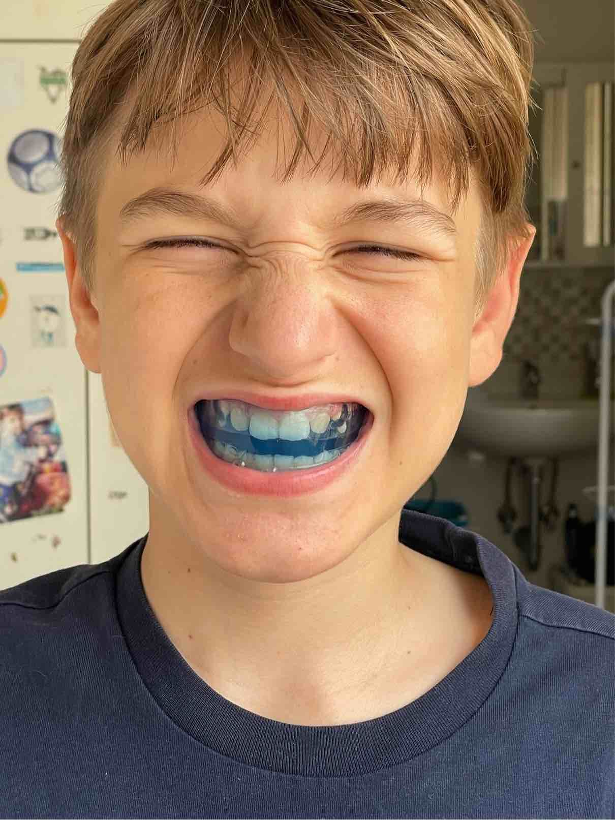 Bambino durante un trattamento estetico dentale.