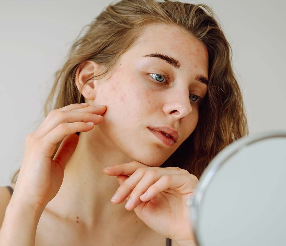 Una persona se mira en un espejo, tocándose la mejilla mientras examina la textura de la piel y las pequeñas imperfecciones.