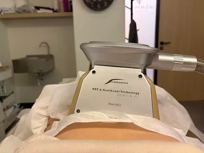Dispositivo CoolSculpting en el abdomen de una persona en un entorno de spa.