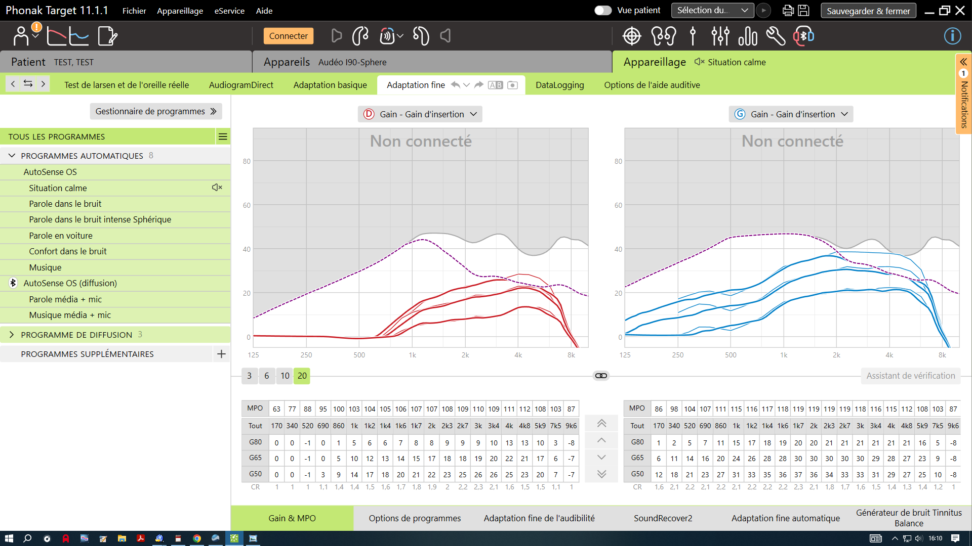 Appareil auditif avec réglages