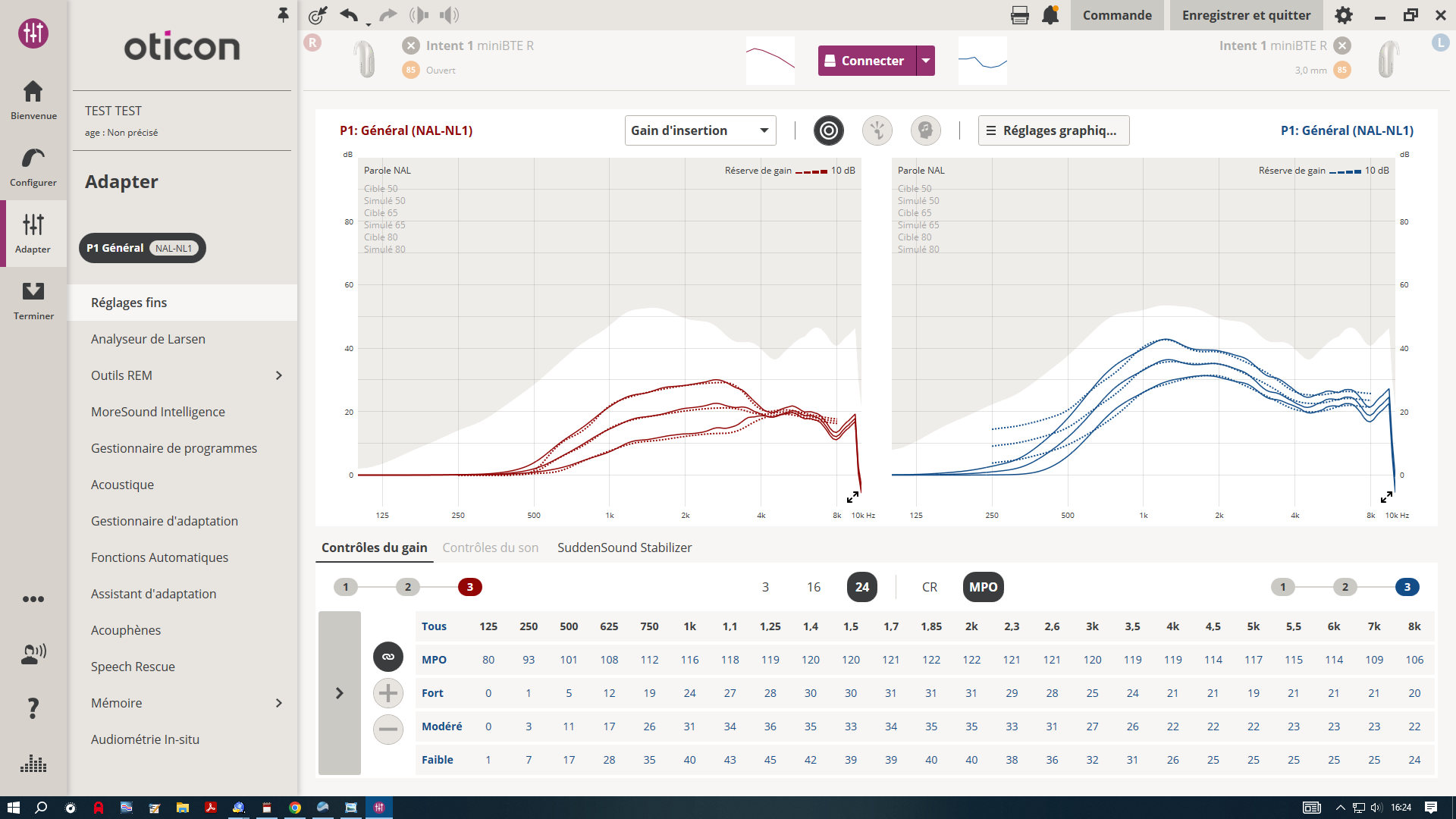 Solution auditive sur mesure