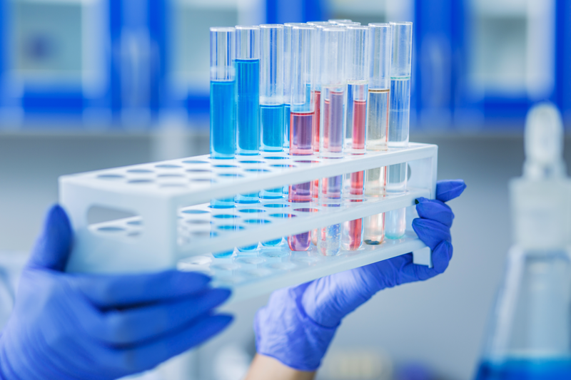Manos enguantadas sosteniendo un soporte para tubos de ensayo con muestras de sangre en un laboratorio.