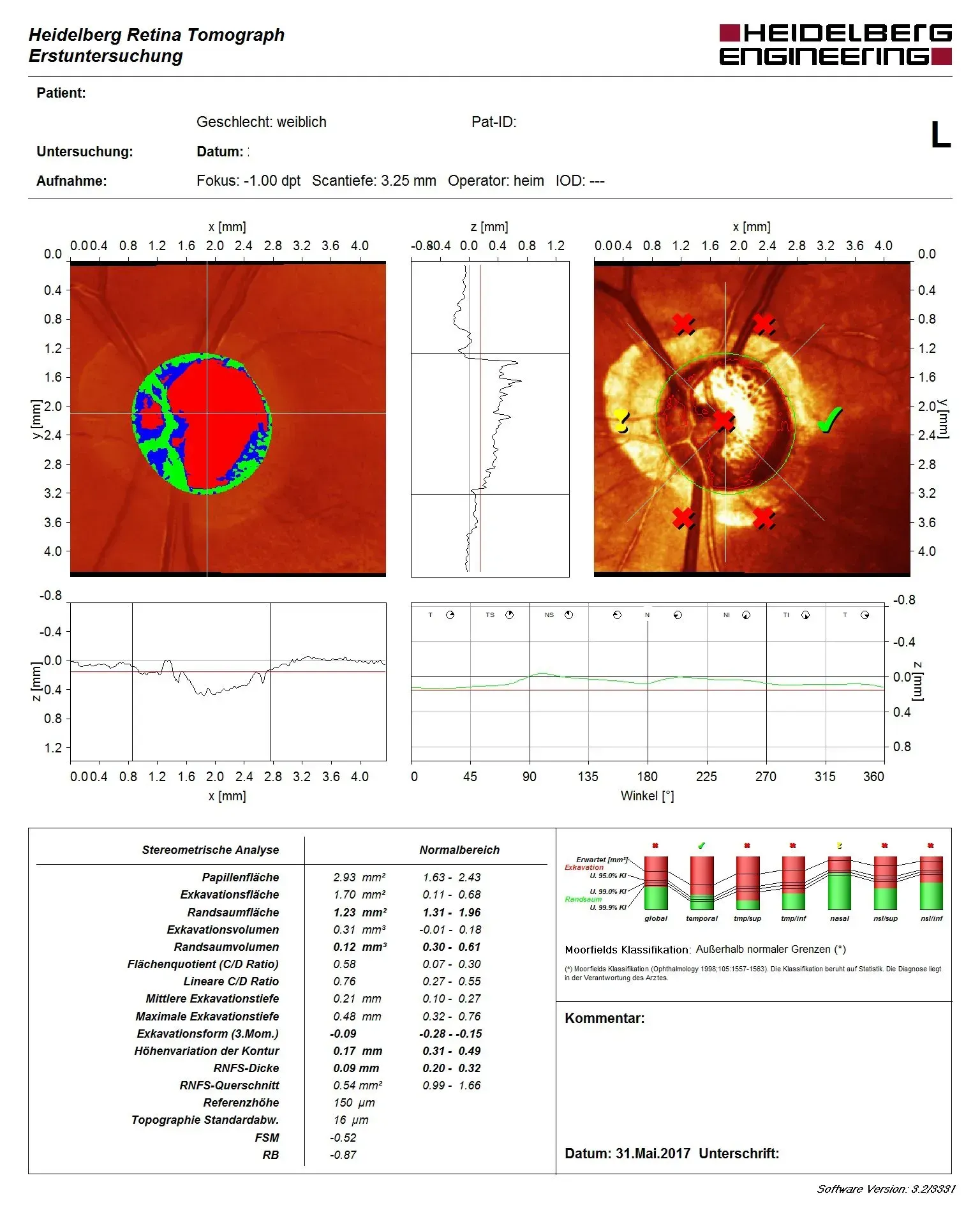 HRTGlaukom vom Stefan Beckmann - Facharzt für Augenheilkunde