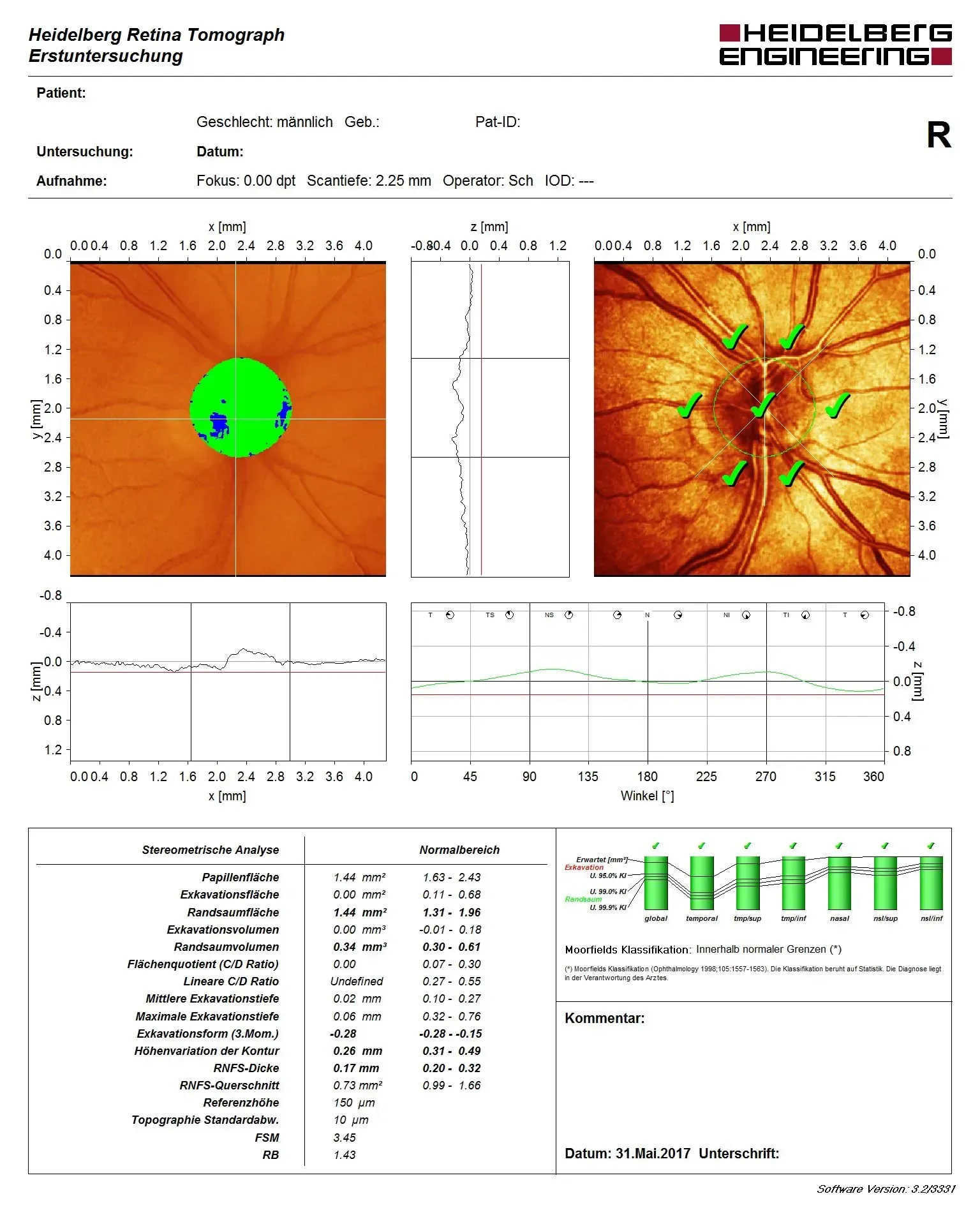 HRT Gesund vom Stefan Beckmann - Facharzt für Augenheilkunde