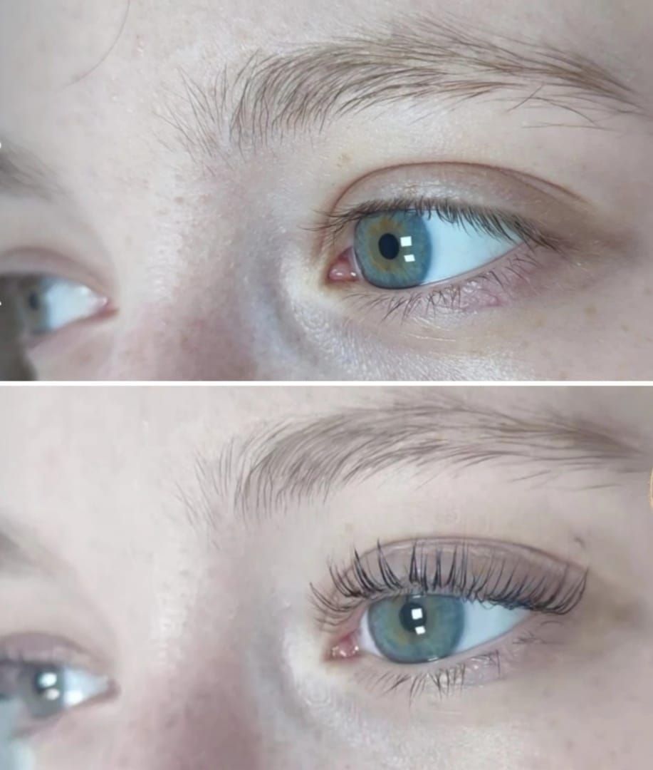 Una fotografía de antes y después de los ojos de una mujer con pestañas.