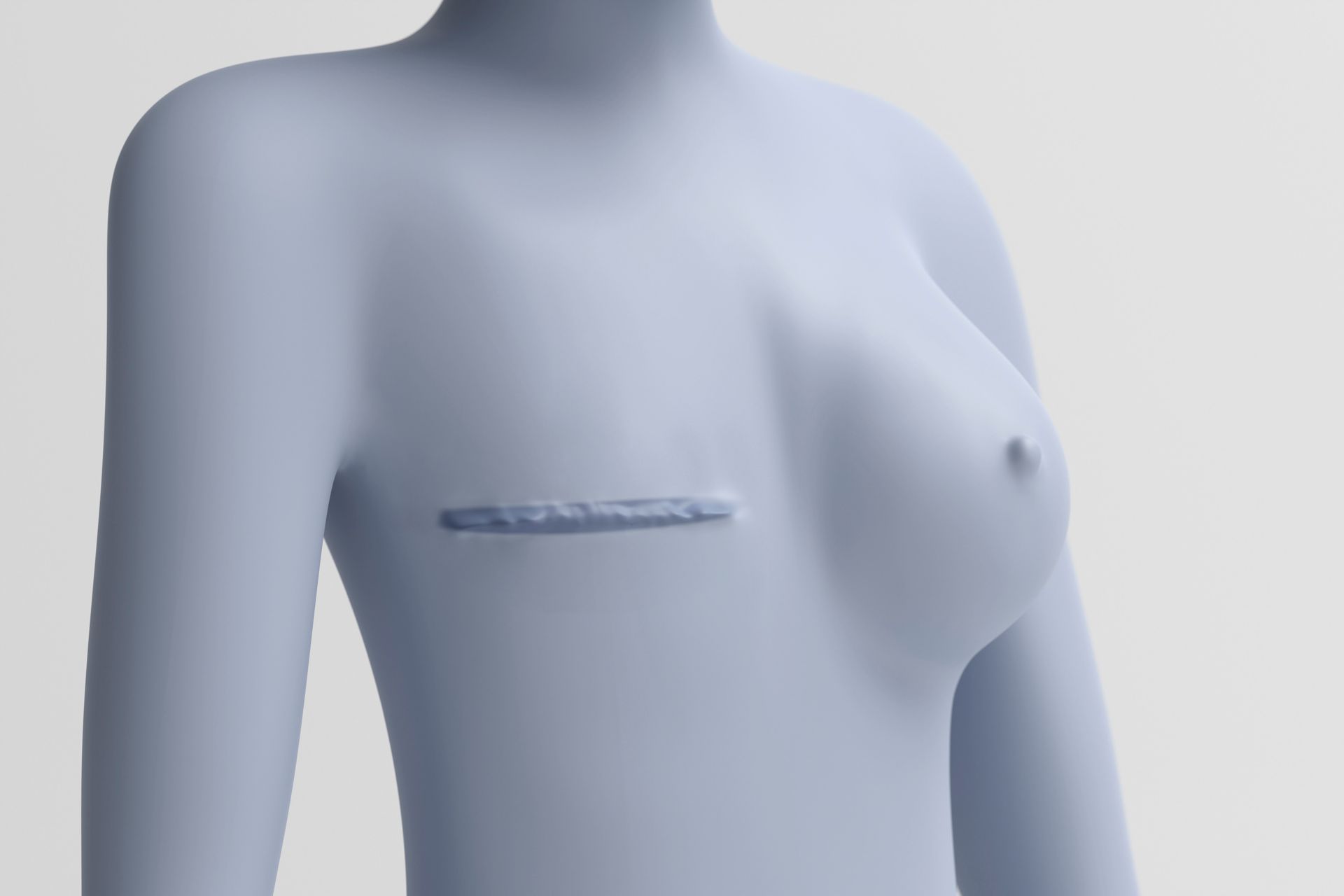 Ein blaues 3D-Modell des Oberkörpers einer Person mit einer Narbe quer über der Brust.