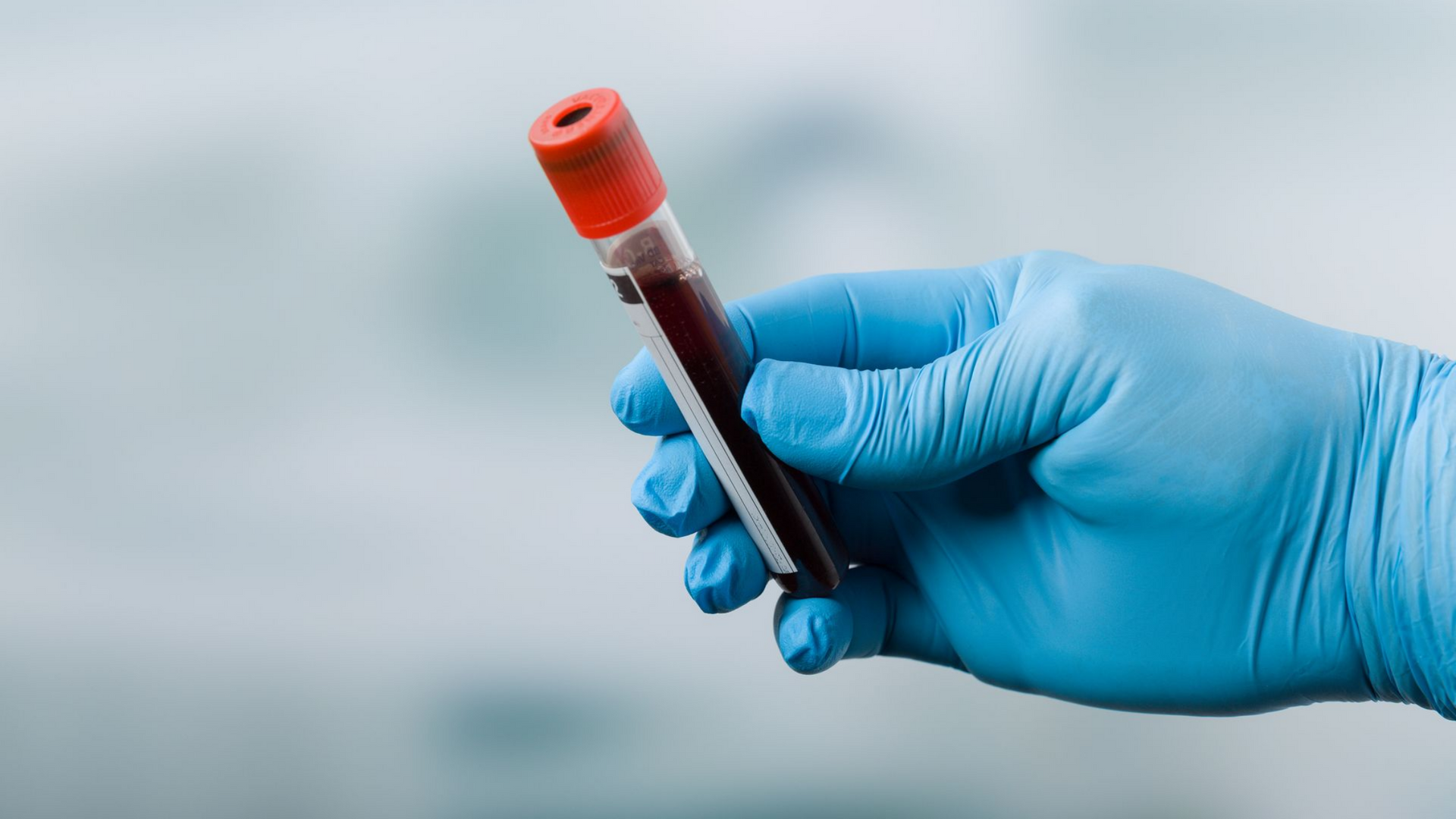 Main gantée tenant un tube d'échantillon de sang avec un bouchon rouge sur un fond flou.