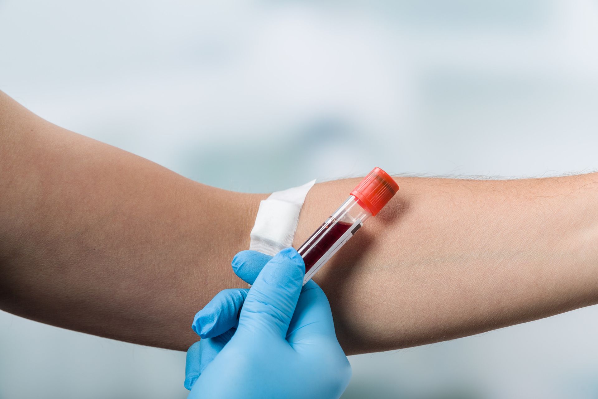 Bras avec un bandage, un professionnel de la santé portant des gants bleus tenant une fiole de sang.
