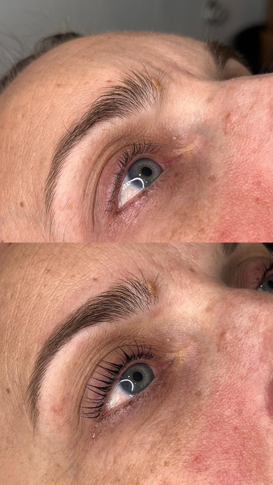 Manos enguantadas aplicando una mascarilla facial blanca en el rostro de una mujer.
