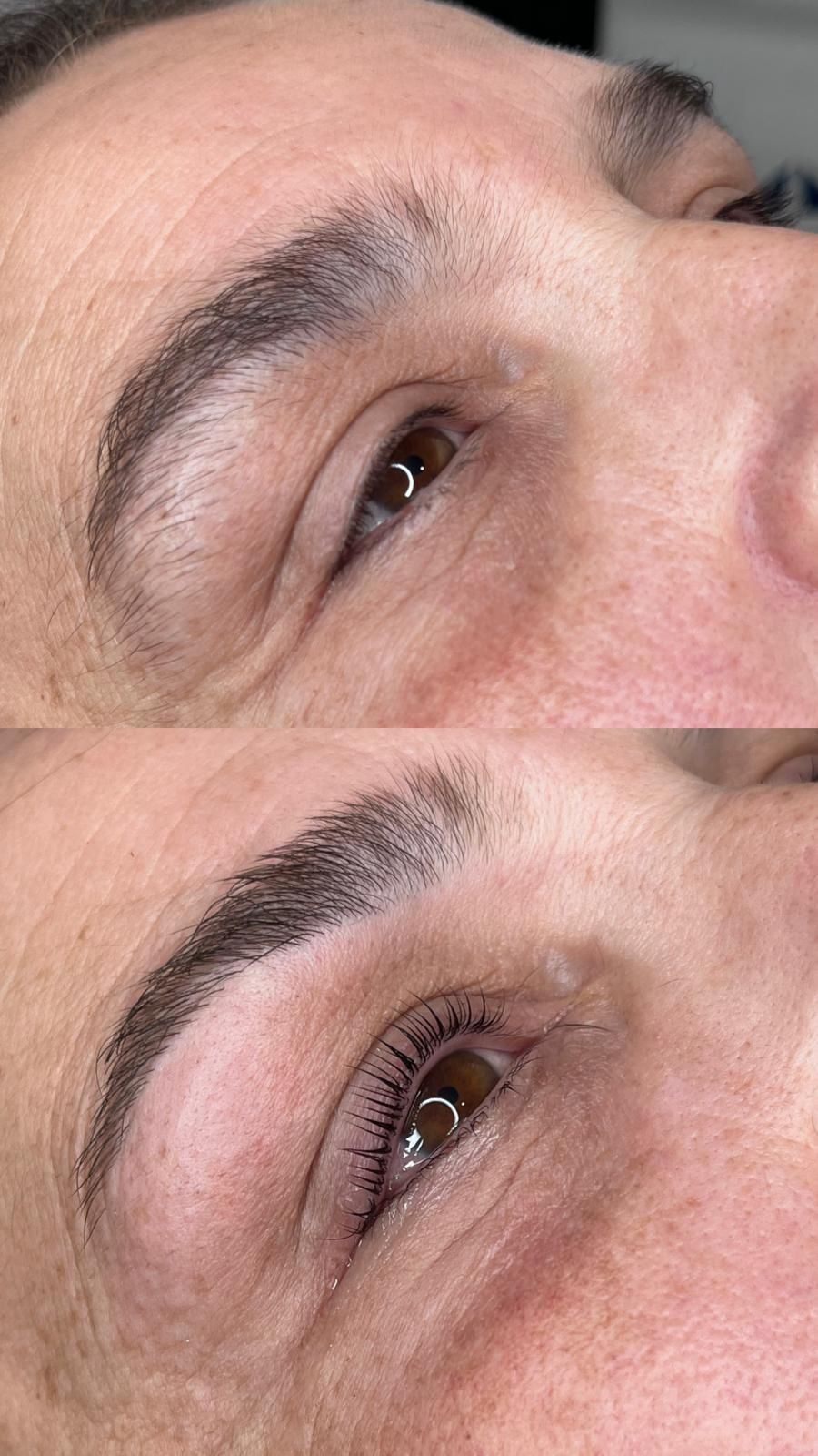Manos enguantadas colocando una mascarilla blanca a una mujer con los ojos cerrados.