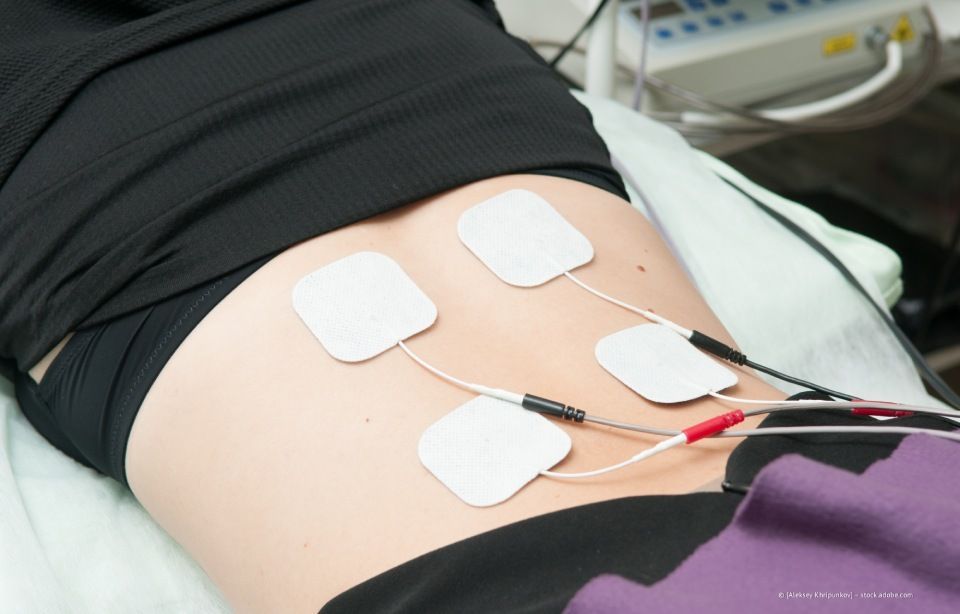 Haut mit vier Elektrodenpads, die über Drähte mit einem medizinischen Gerät verbunden sind, wahrscheinlich einem TENS-Gerät.