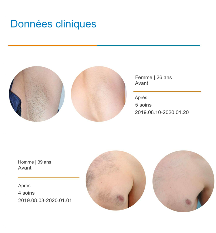 Données clinique pour le laser à diode
