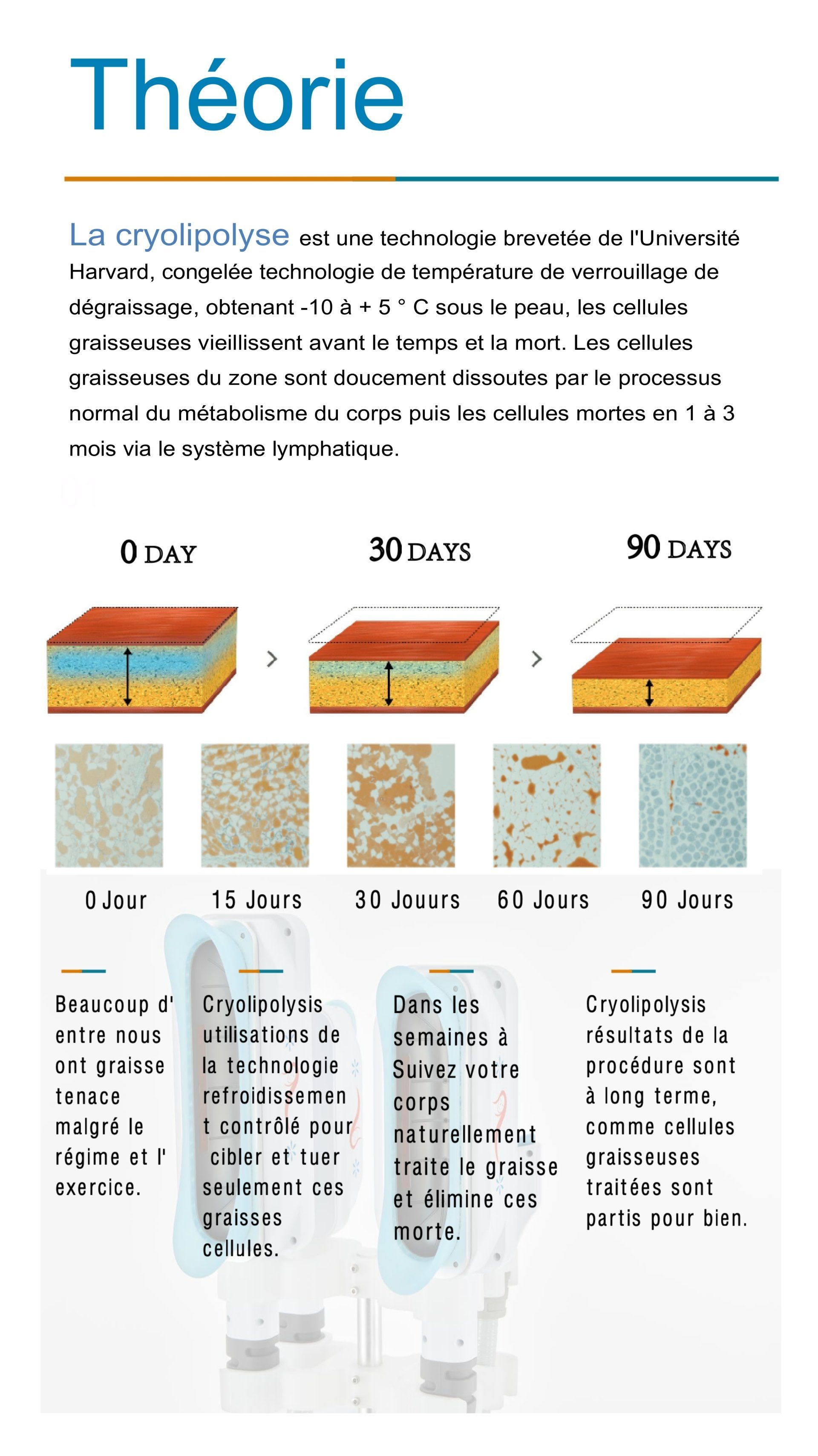 La cryolipolyse en théorie