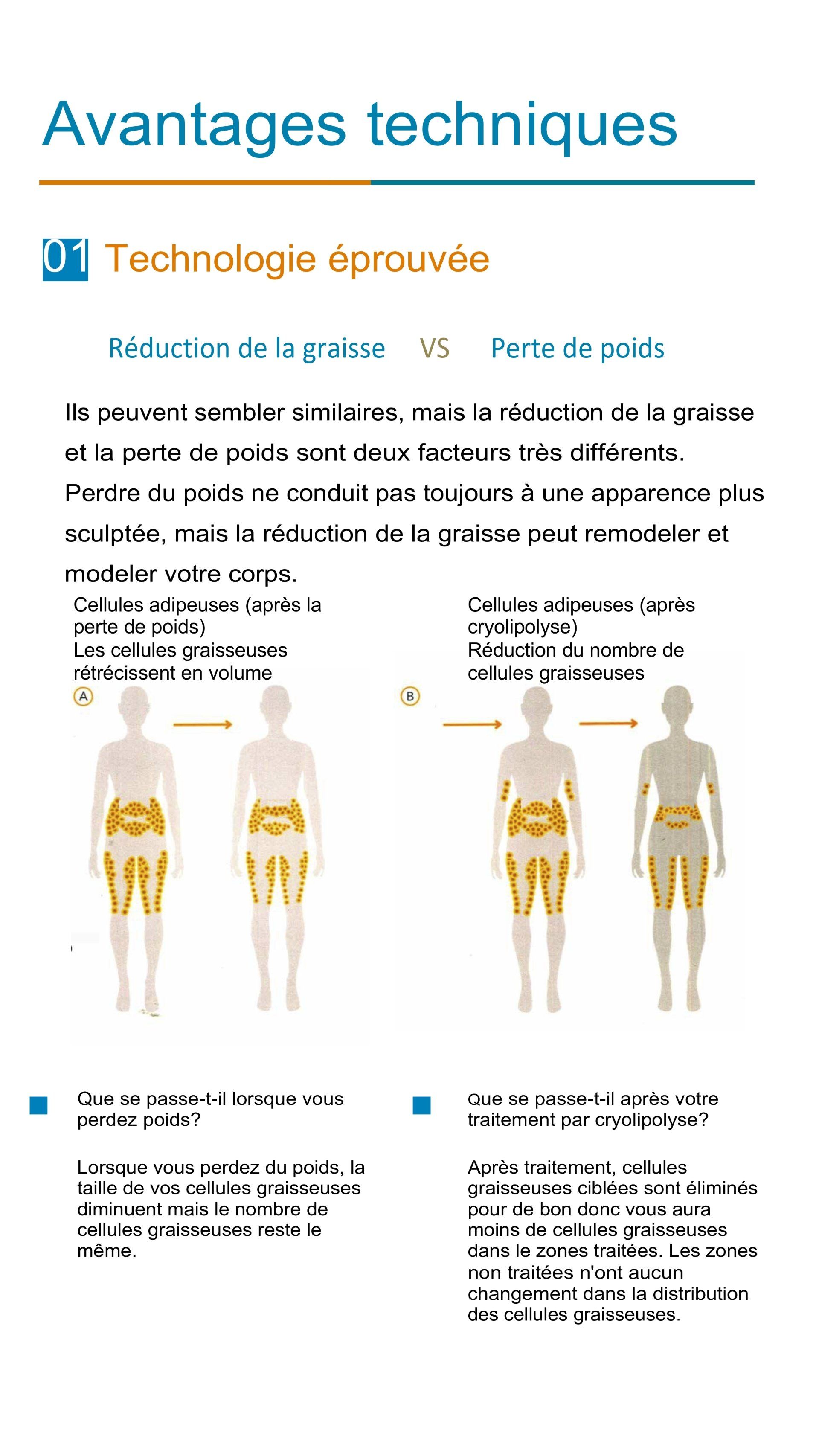 Les avantages de la cryolipolyse