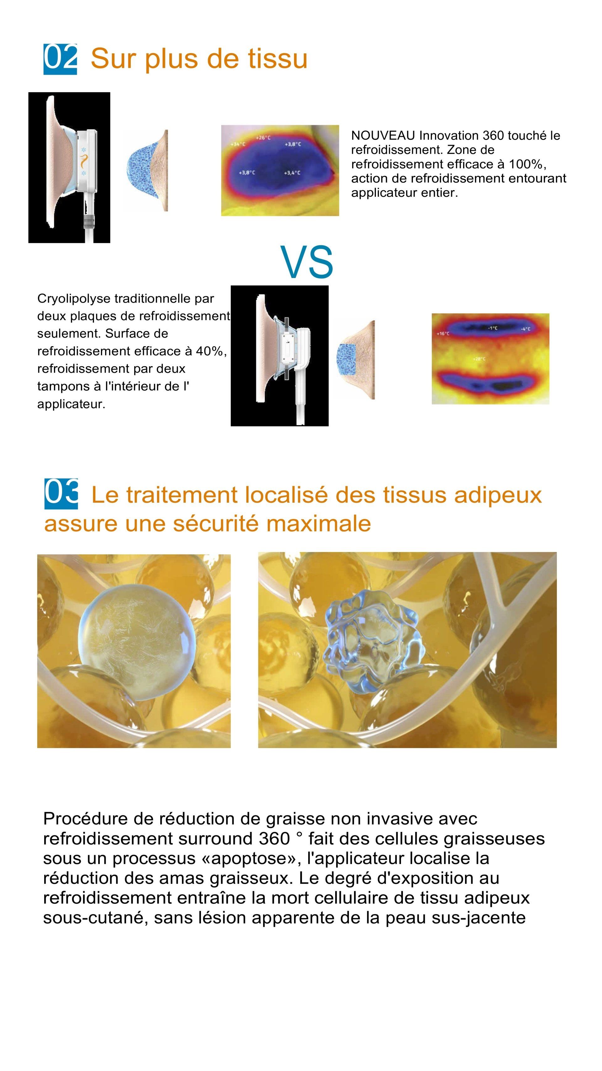 Action sur le corps de la cryolipolyse