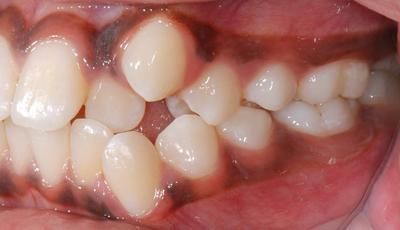 1 droit avant - Cabinet d'orthodontie Epars - Chiarini - Montreux