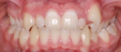 2 face avant - Cabinet d'othodontie Epars - Montreux