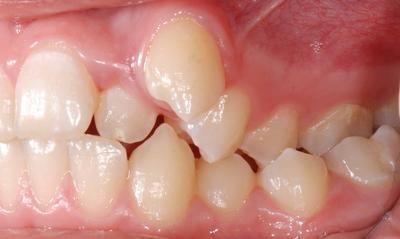 2 droite avant - Cabinet d'othodontie Epars - Montreux