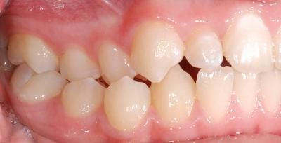 2 gauche avant - Cabinet d'othodontie Epars - Montreux