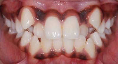 1 face avant - Cabinet d'orthodontie Epars - Chiarini - Montreux