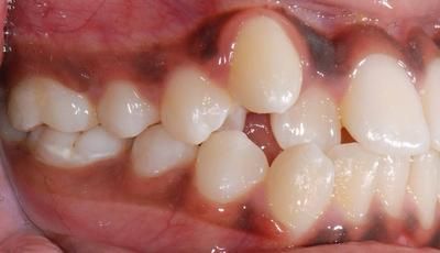 1 gauche avant - Cabinet d'orthodontie Epars - Chiarini - Montreux