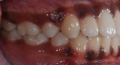 1 gauche avant -Cabinet d'orthodontie Epars - Chiarini - Montreux