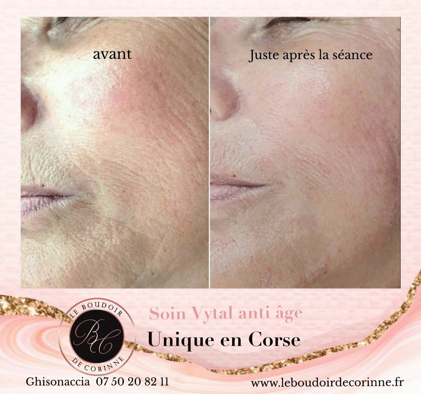 Soin Vytal anti-âge