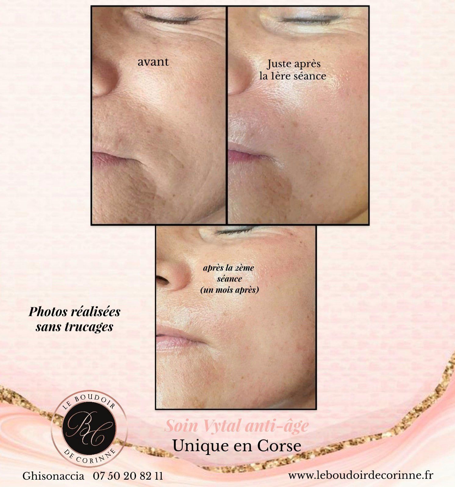 Peau lisse et nourrit