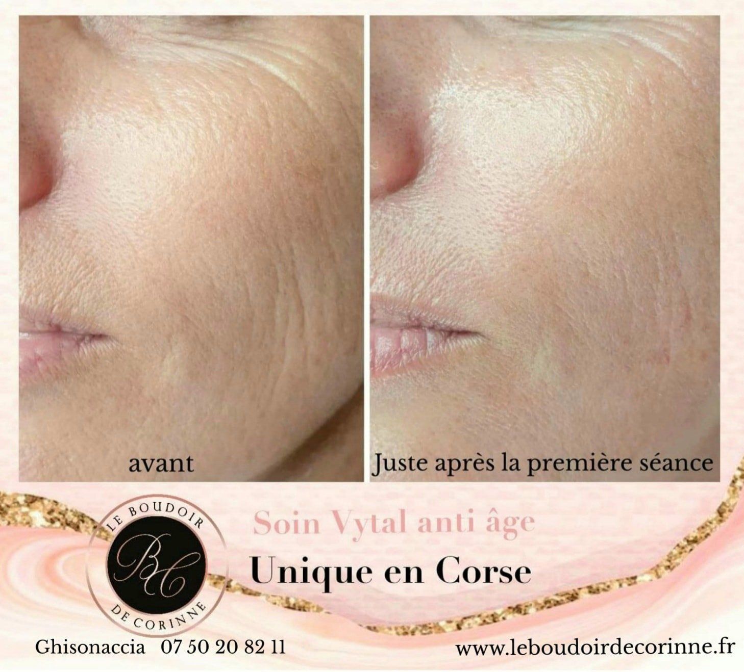 Soin Vytal anti-âge peau lisse