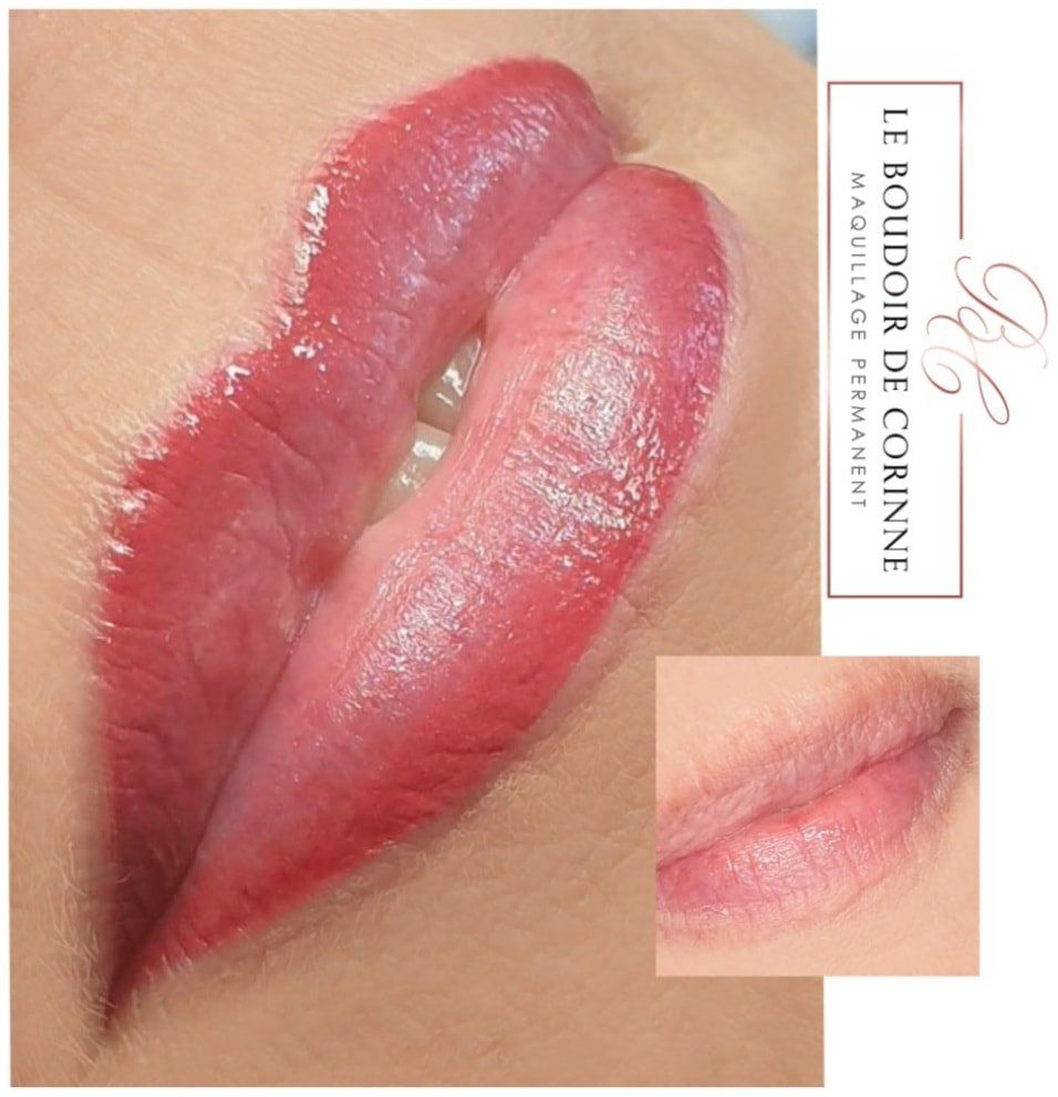 pigmentation sur les contours des lèvres