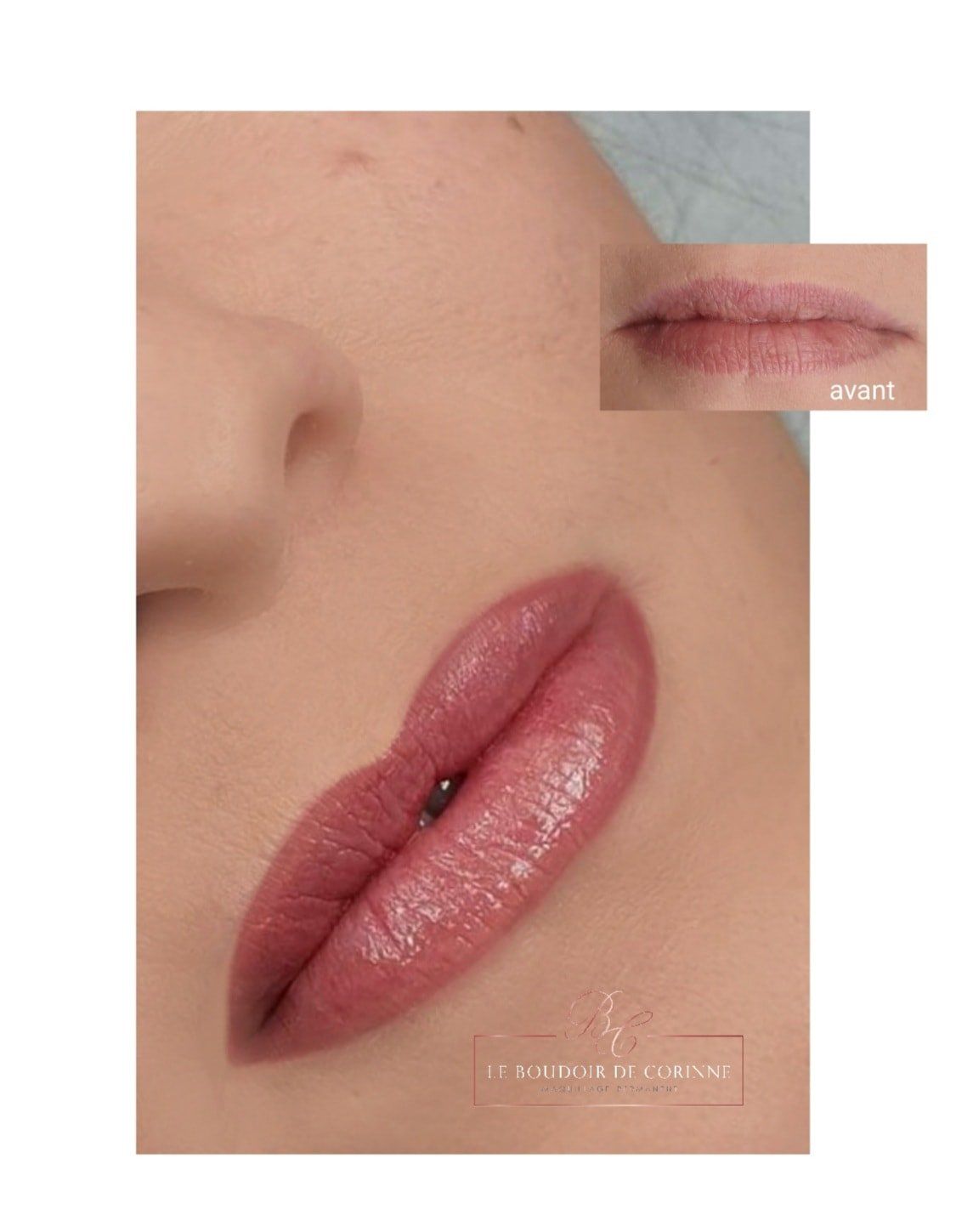 avant/ après lèvre plus pigmentée