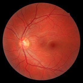 Normaler Augenhintergrund - Augenarztpraxis am Stampfenbachplatz - Zürich