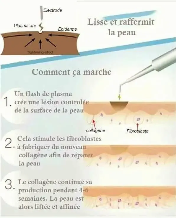 Lèvres après un maquillage permanent avec un pigment rouge
