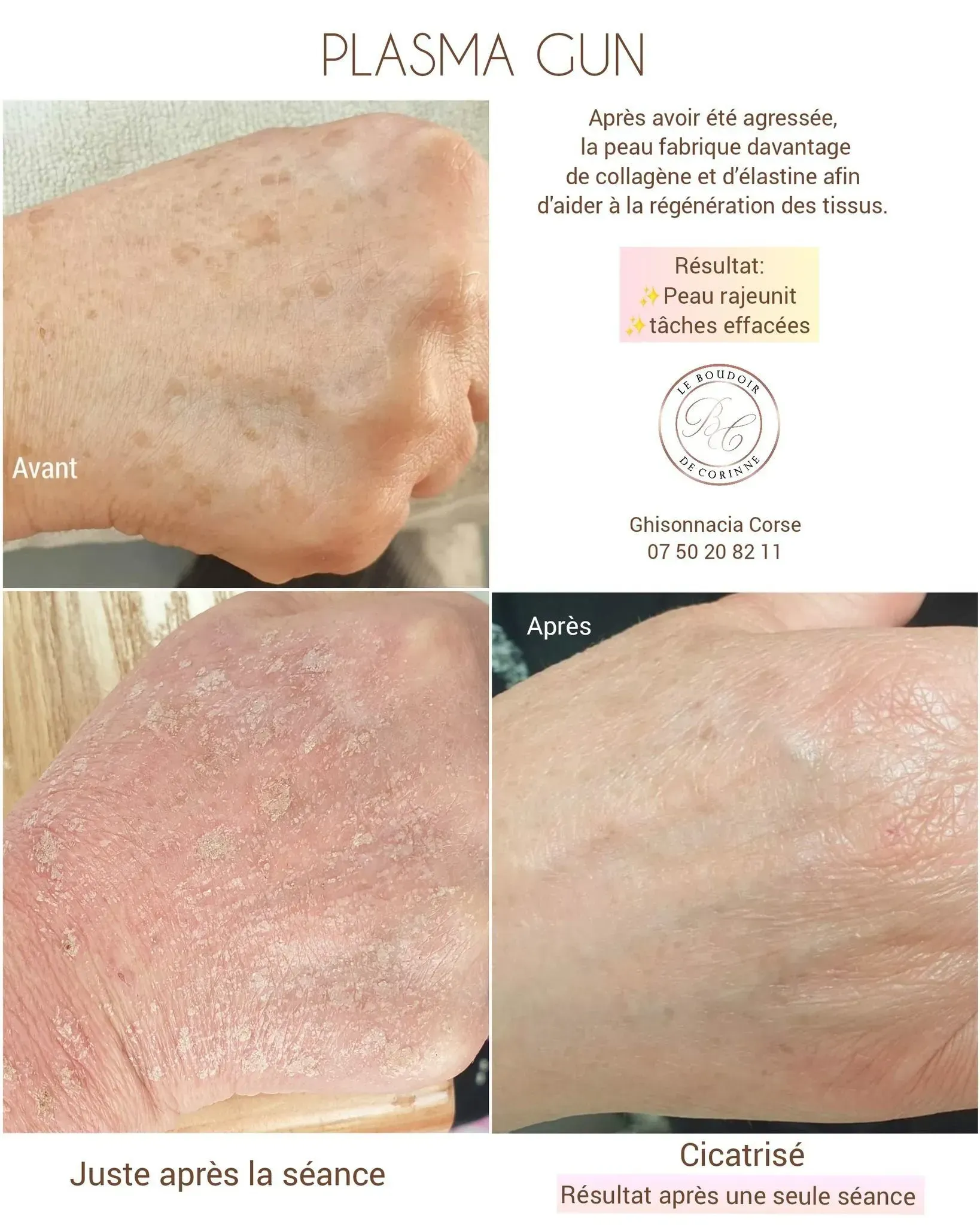 Lèvres après un maquillage permanent avec un pigment rose clair