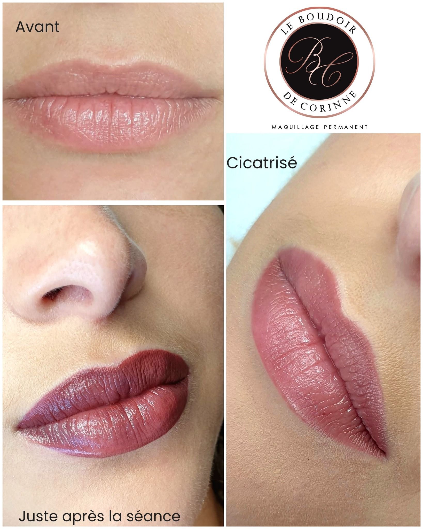 Collage avant/après des lèvres montrant l'évolution de la pigmentation, d'une couleur naturelle à un bordeaux brillant.
