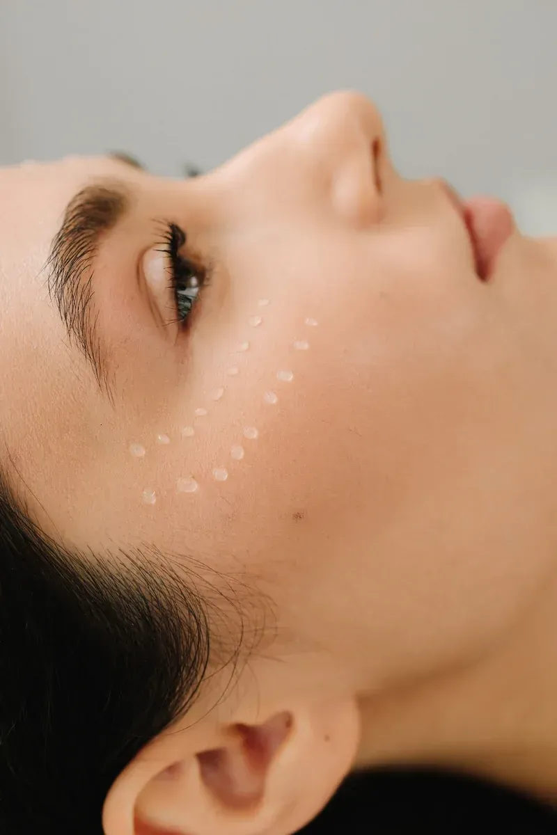 Tratamiento facial con estimuladores de col&aacute;geno aplicado por especialista en medicina est&eacute;tica para mejorar firmeza y calidad de la piel.