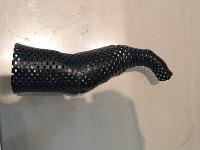 Moulage sur le patient