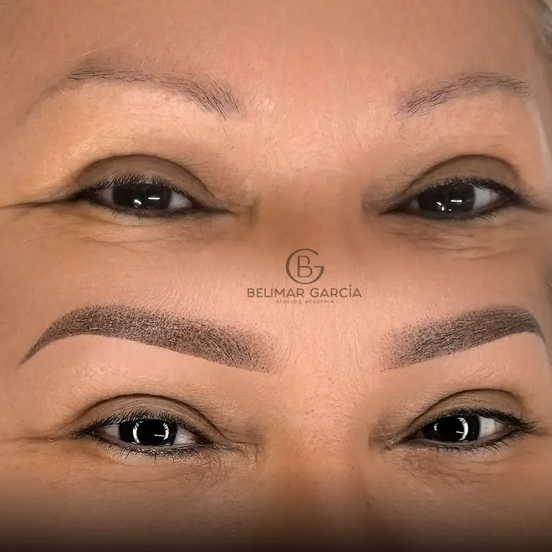 Primer plano del antes y el después de la micropigmentación de cejas, que muestra las cejas con forma definida en el rostro de una mujer.