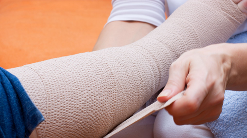 Personne enveloppant une jambe dans un bandage beige, probablement pour un traitement médical ou un soutien en cas de blessure.
