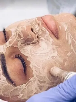 Una mujer está recibiendo un tratamiento facial con una mascarilla en la cara.