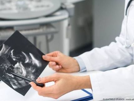 Arzt mit Ultraschallbild in der Hand