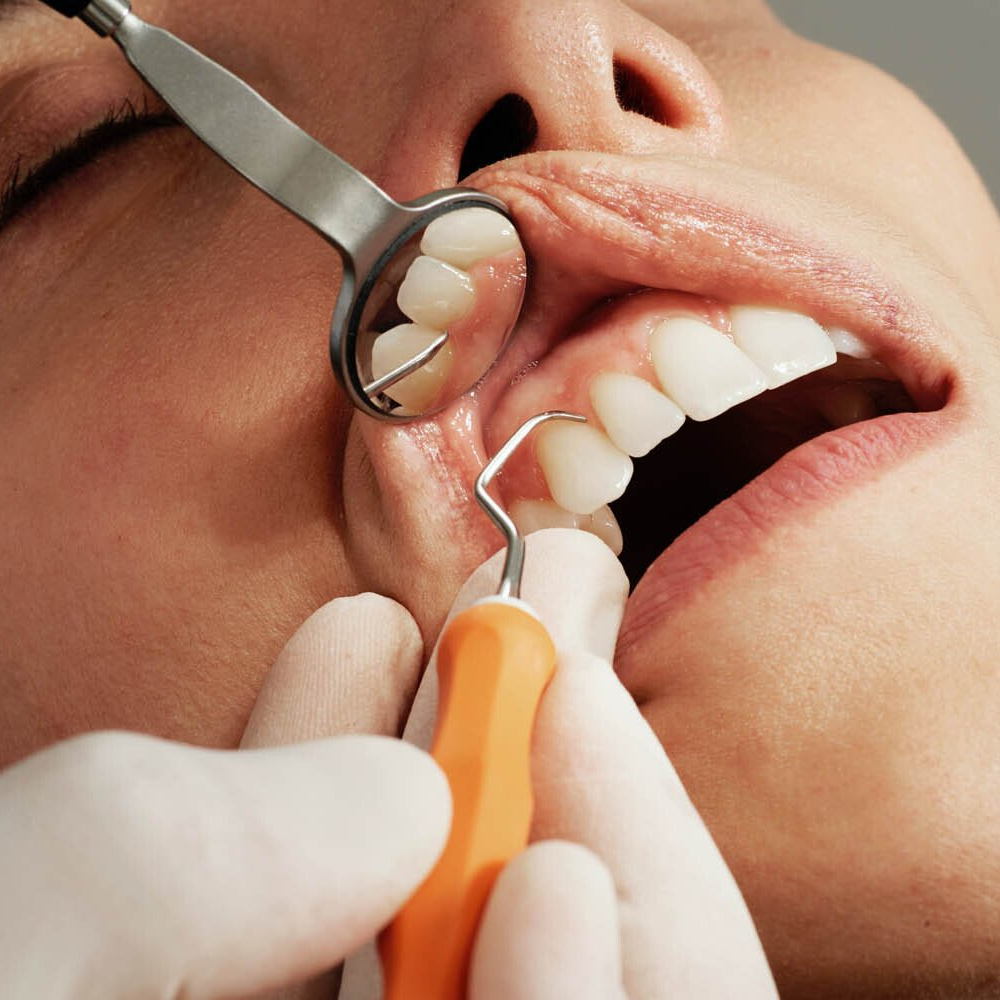 Dentiste vérifiant les dents d'un patient