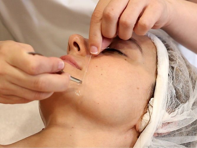 Cosmetóloga realizando acupuntura facial a una clienta tumbada en una camilla de tratamiento.