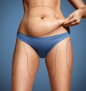 Persona en ropa interior azul pellizcándose el vientre y los muslos, con las zonas del cuerpo delineadas sobre un fondo azul.